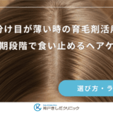 女性の分け目が薄い時の育毛剤活用ガイド｜初期段階で食い止めるヘアケア