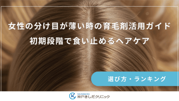 女性の分け目が薄い時の育毛剤活用ガイド｜初期段階で食い止めるヘアケア