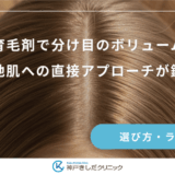 女性用育毛剤で分け目のボリュームアップ｜地肌への直接アプローチが鍵