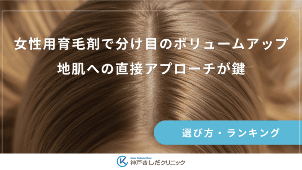 女性用育毛剤で分け目のボリュームアップ｜地肌への直接アプローチが鍵