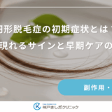 円形脱毛症の初期症状とは?女性に現れるサインと早期ケアの重要性