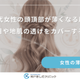 20代女性の頭頂部が薄くなる原因｜分け目や地肌の透けをカバーする対策