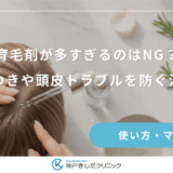 育毛剤が多すぎるのはNG？ベタつきや頭皮トラブルを防ぐ注意点