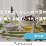 育毛剤で頭皮が赤くなるのは刺激のサイン？使用を中断すべき判断基準