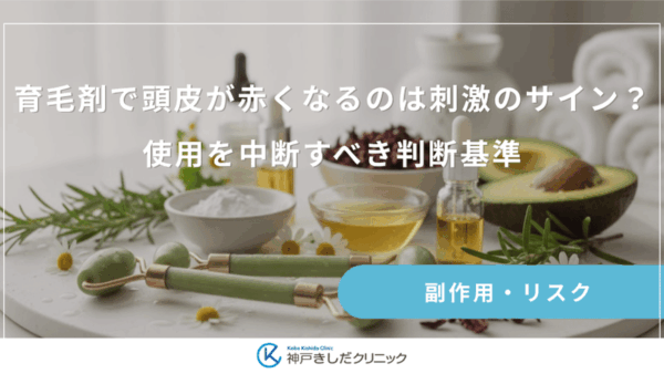 育毛剤で頭皮が赤くなるのは刺激のサイン？使用を中断すべき判断基準