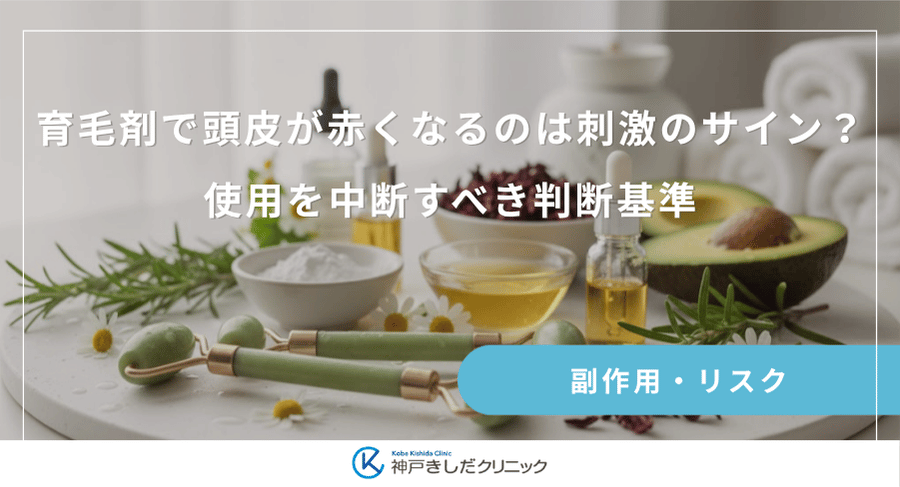 育毛剤で頭皮が赤くなるのは刺激のサイン？使用を中断すべき判断基準