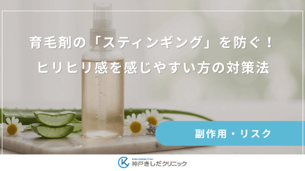 育毛剤の「スティンギング」を防ぐ！ヒリヒリ感を感じやすい方の対策法