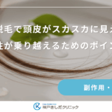 初期脱毛で頭皮がスカスカに見える？女性が乗り越えるためのポイント