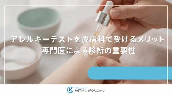 アレルギーテストを皮膚科で受けるメリット｜専門医による診断の重要性