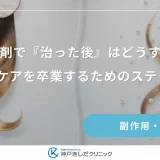 育毛剤で「治った後」はどうすべき？ケアを卒業するためのステップ