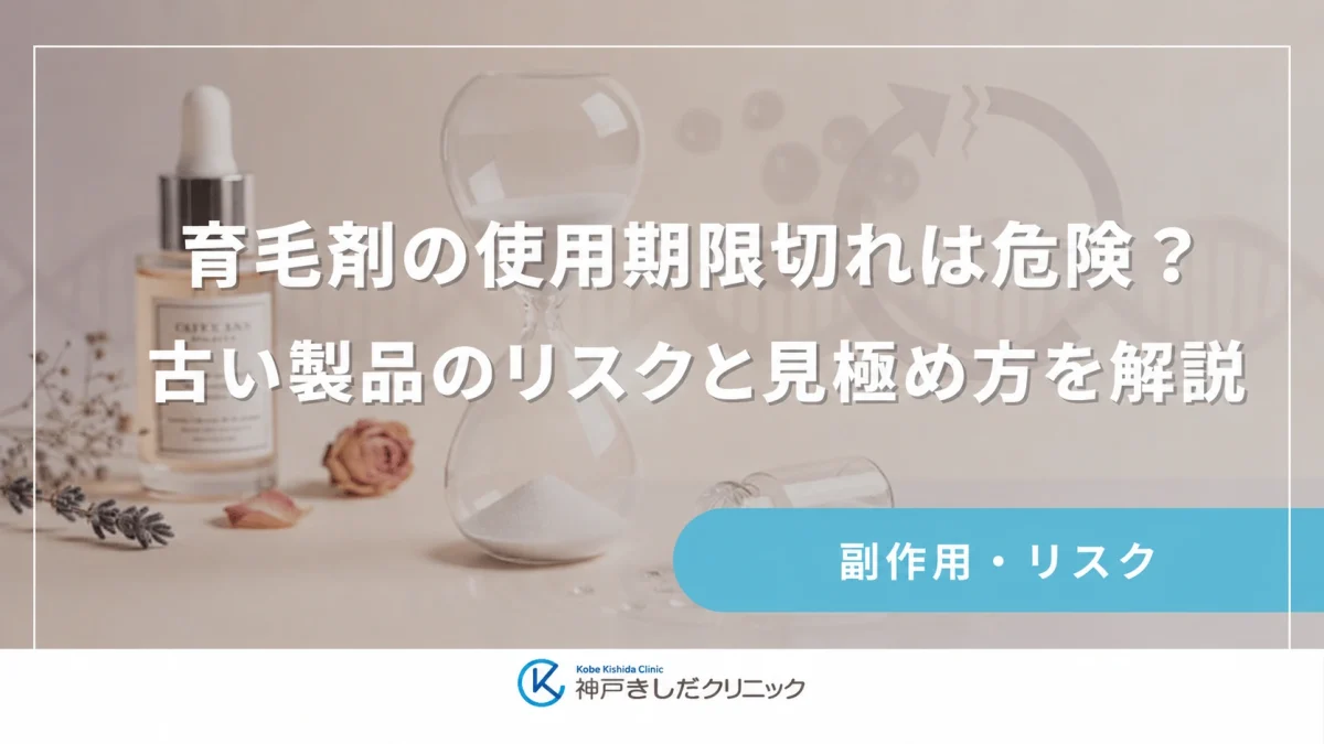 育毛剤の使用期限切れは危険?古い製品のリスクと見極め方を解説