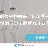 育毛剤の植物由来アレルギーとは｜自然派成分で肌荒れする原因