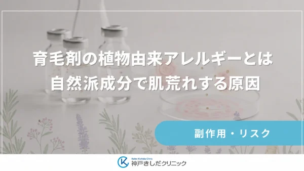 育毛剤の植物由来アレルギーとは｜自然派成分で肌荒れする原因