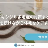 ミノキシジル多毛症の対策まとめ！育毛を続けながら体毛をケアする方法