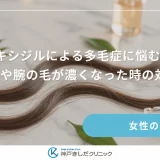 ミノキシジルによる多毛症に悩む女性へ｜顔や腕の毛が濃くなった時の対策