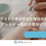 パッチテストで赤みが出た場合の判断基準｜アレルギー反応の見分け方