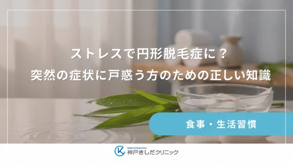 ストレスで円形脱毛症に？突然の症状に戸惑う方のための正しい知識