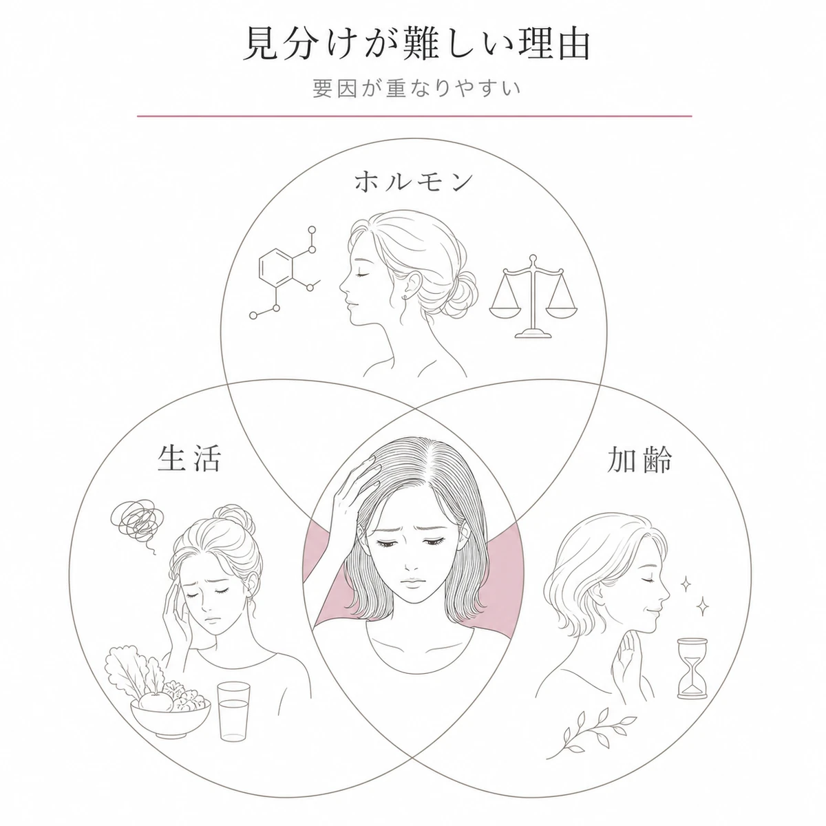 ホルモンやストレスや加齢が重なって薄毛の見分けを難しくする理由を表した線画イラスト