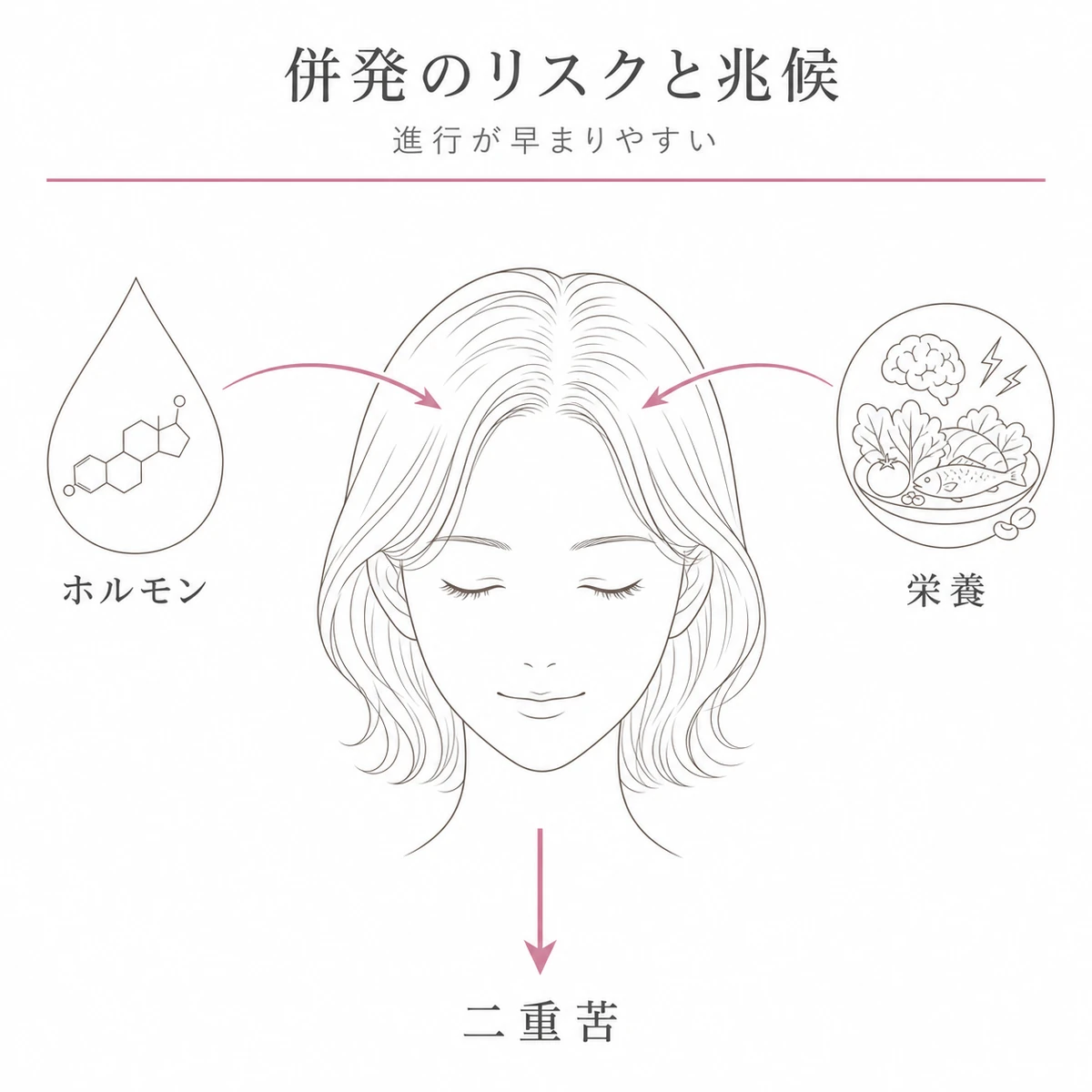 ホルモンと栄養の要因が同時に作用して進行が早まる併発のリスクを表した線画イラスト