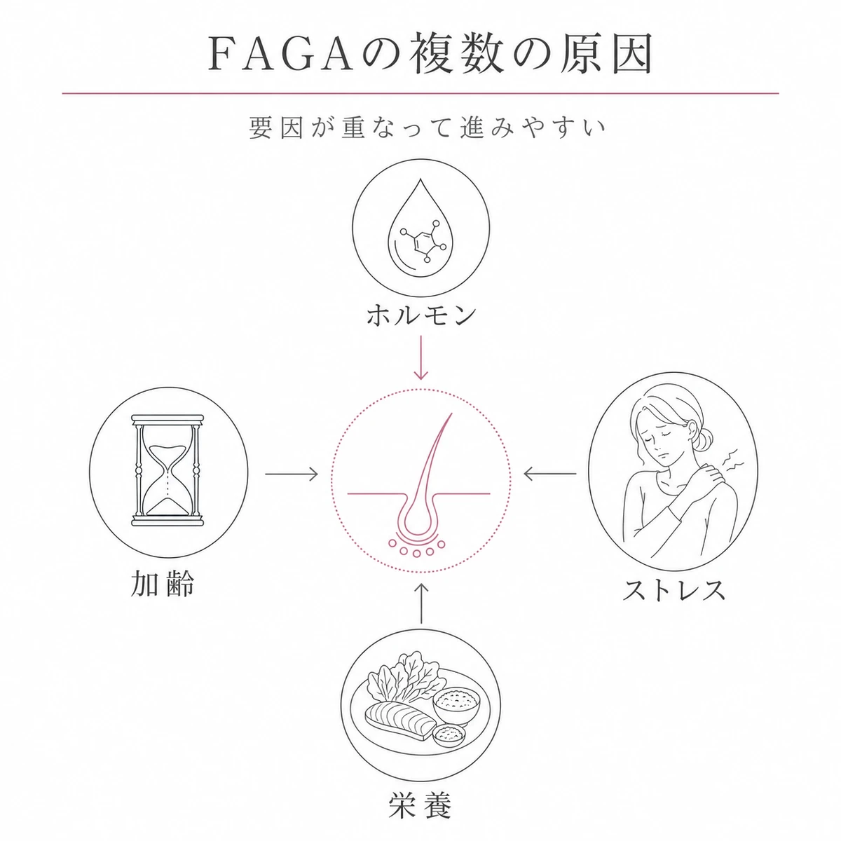 ホルモン・ストレス・栄養・加齢が重なって薄毛につながる女性特有の原因を相関図で表した線画イラスト