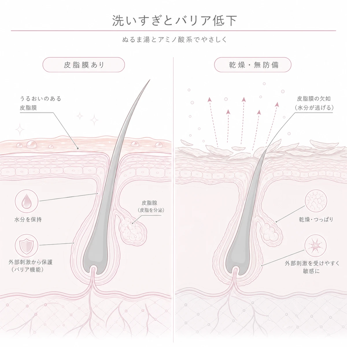 皮脂膜が守る健康な頭皮と洗いすぎで乾燥しバリアが低下した頭皮を左右で見比べる線画イラスト