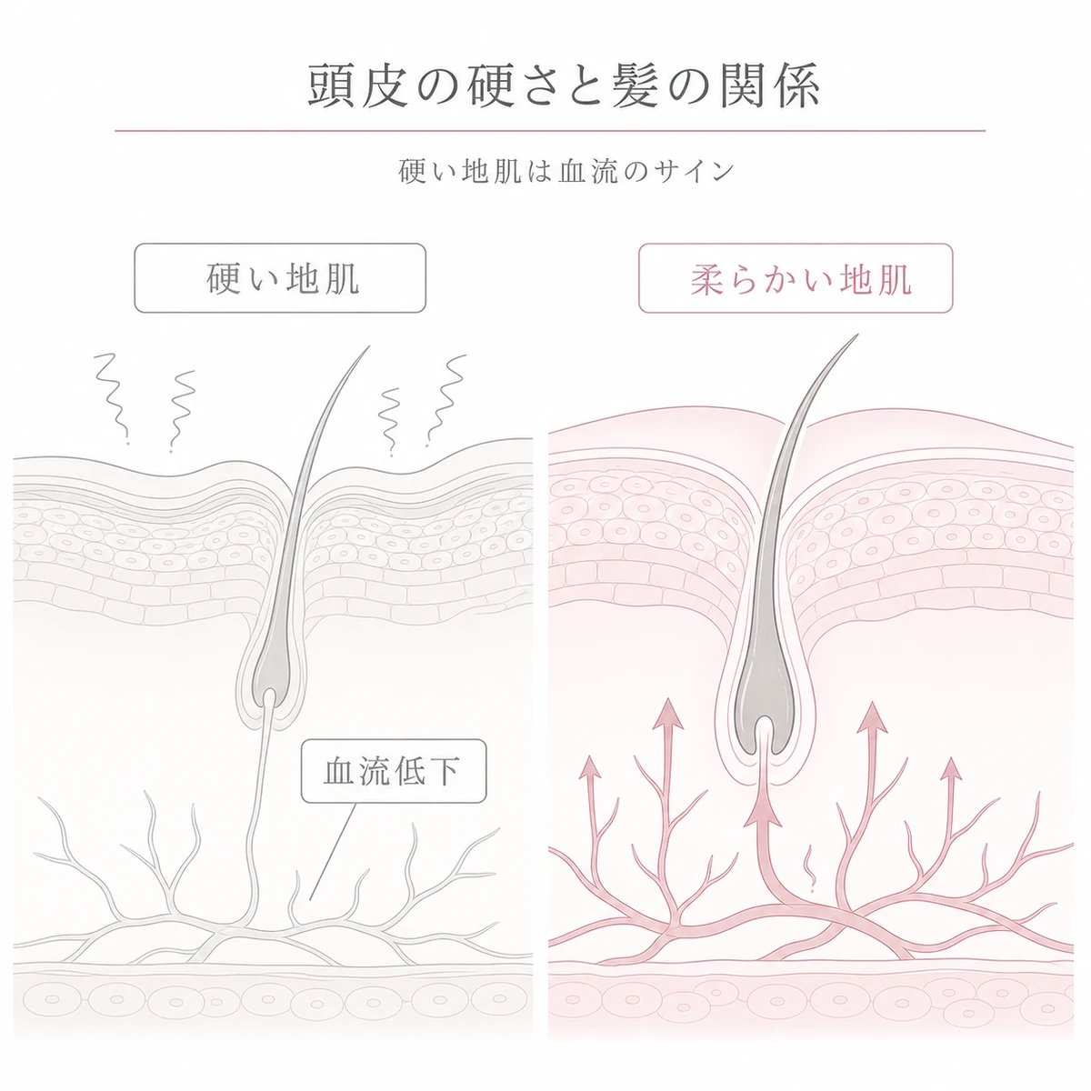 硬い地肌と柔らかい地肌の断面を見比べ血流と毛根への栄養の違いを表した線画イラスト