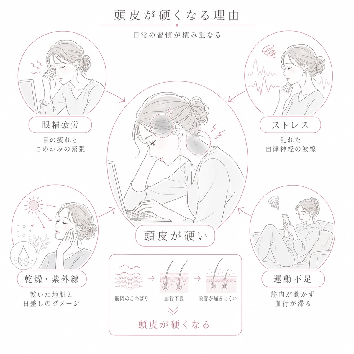 眼精疲労やストレス乾燥運動不足が重なって頭皮を硬くする主な理由を表した線画イラスト