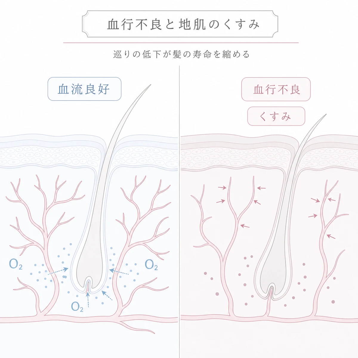 血流が豊かな頭皮と毛細血管が収縮しくすんだ血行不良の頭皮を左右で見比べる断面の線画イラスト