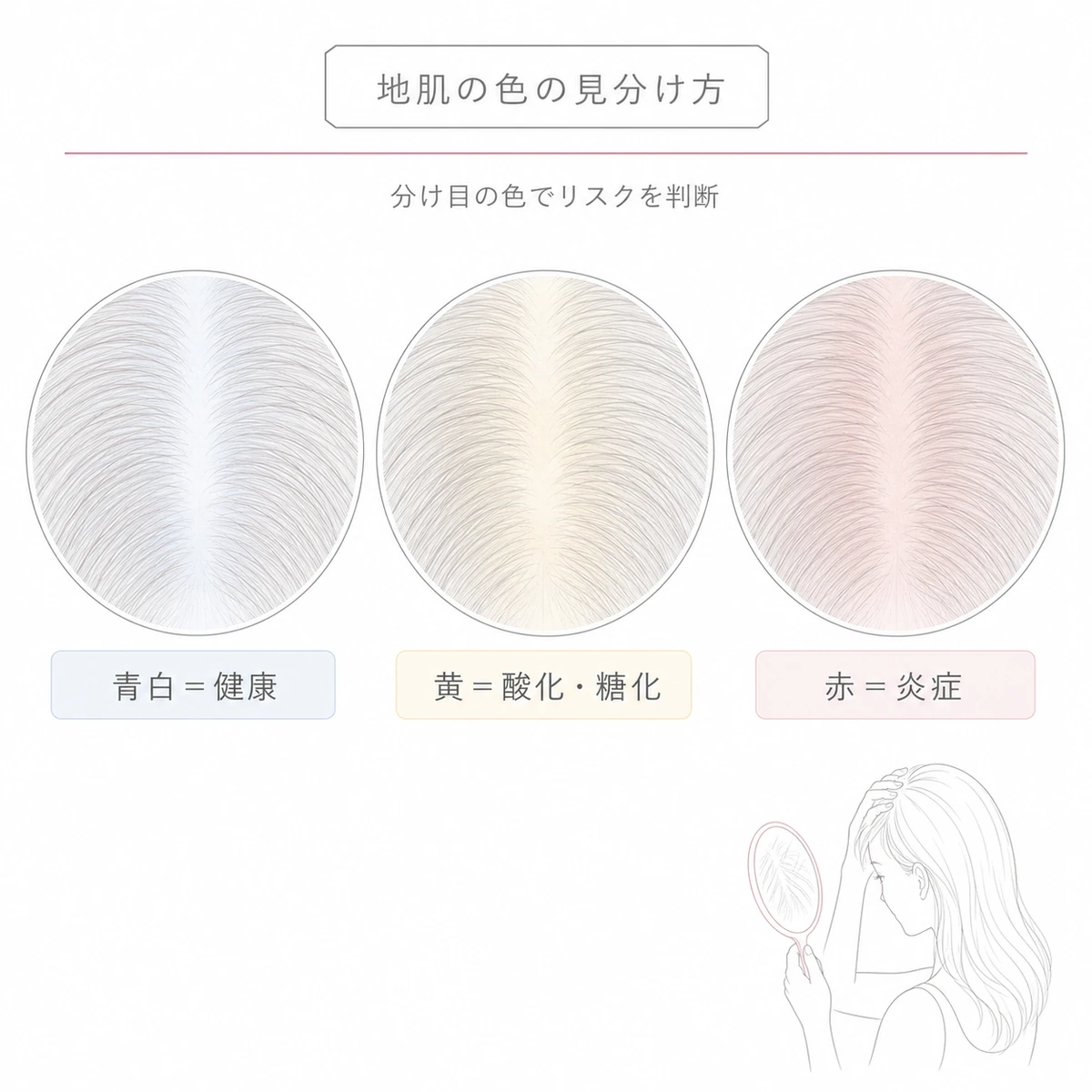 青白と黄色と赤の地肌サンプルで健康と注意すべき変色を見分ける頭皮診断を並べた線画イラスト