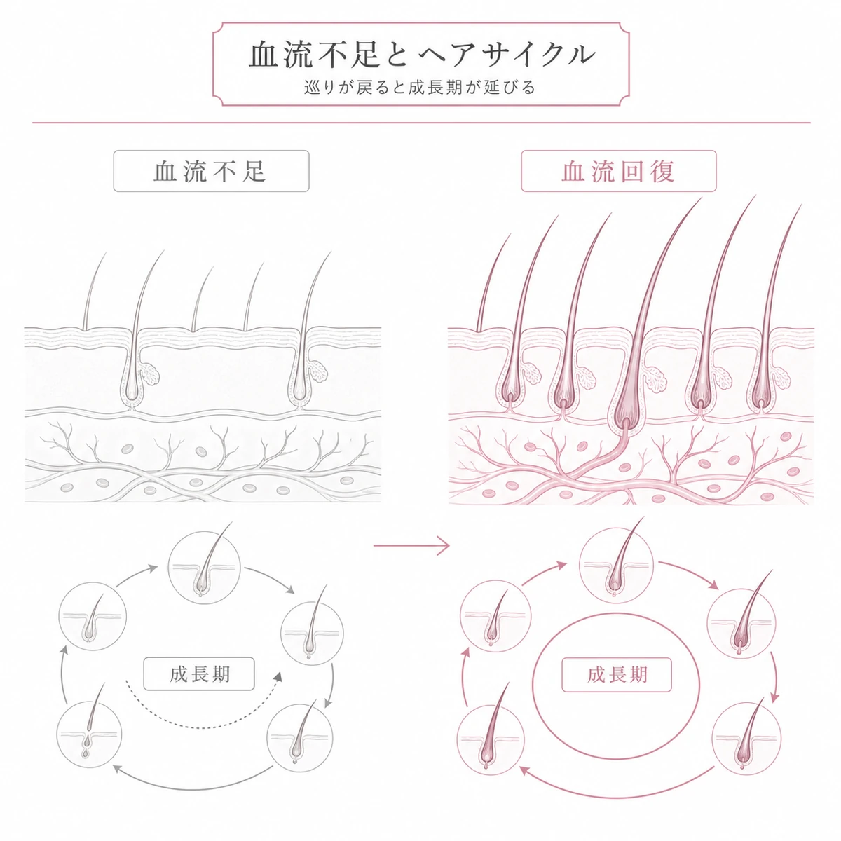 血流不足で細る髪と血流回復で太く育つ髪を左右で対比したヘアサイクルの線画イラスト