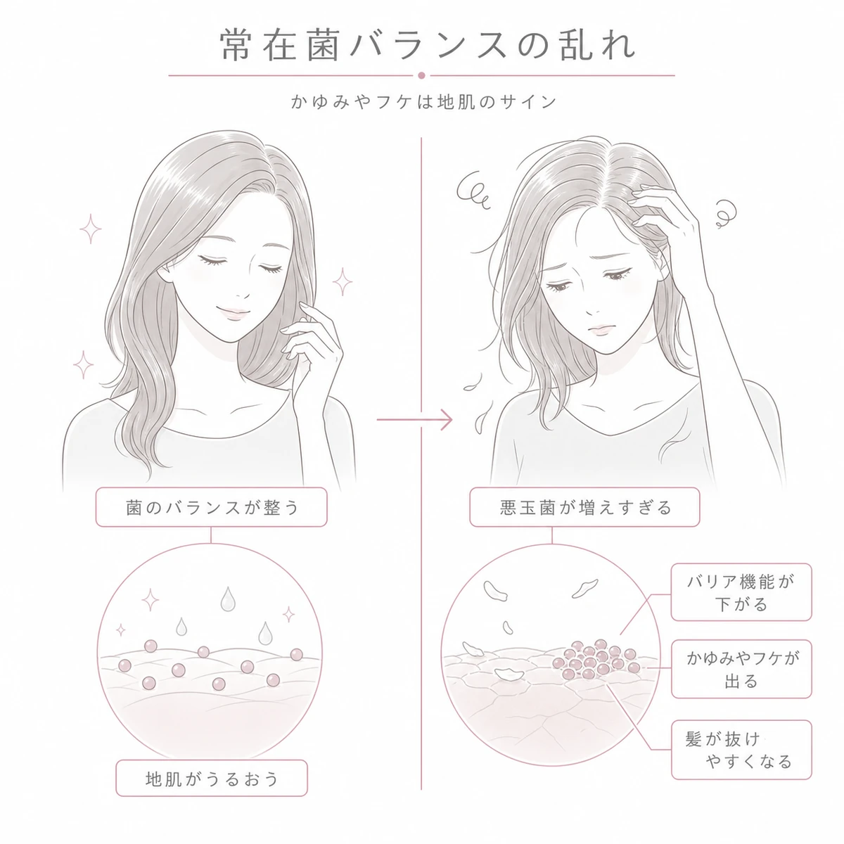 整った地肌と常在菌バランスが崩れた地肌を左右で対比した線画イラスト