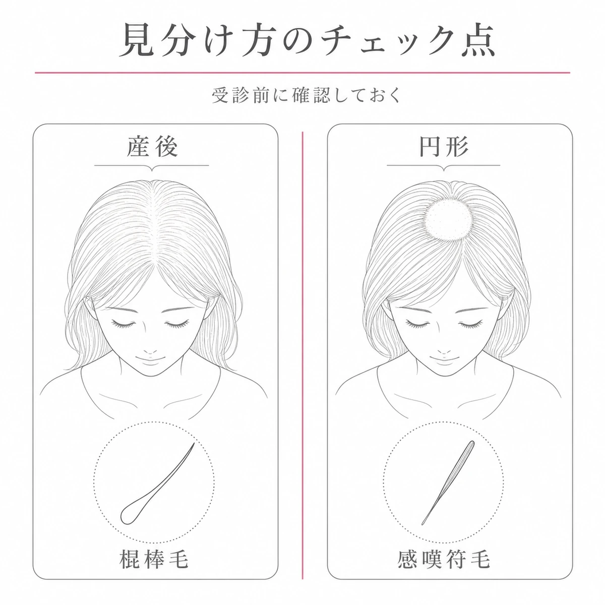 全体にまばらな棍棒毛と丸い脱毛斑の感嘆符毛という見分け方のチェック点を対比した線画イラスト