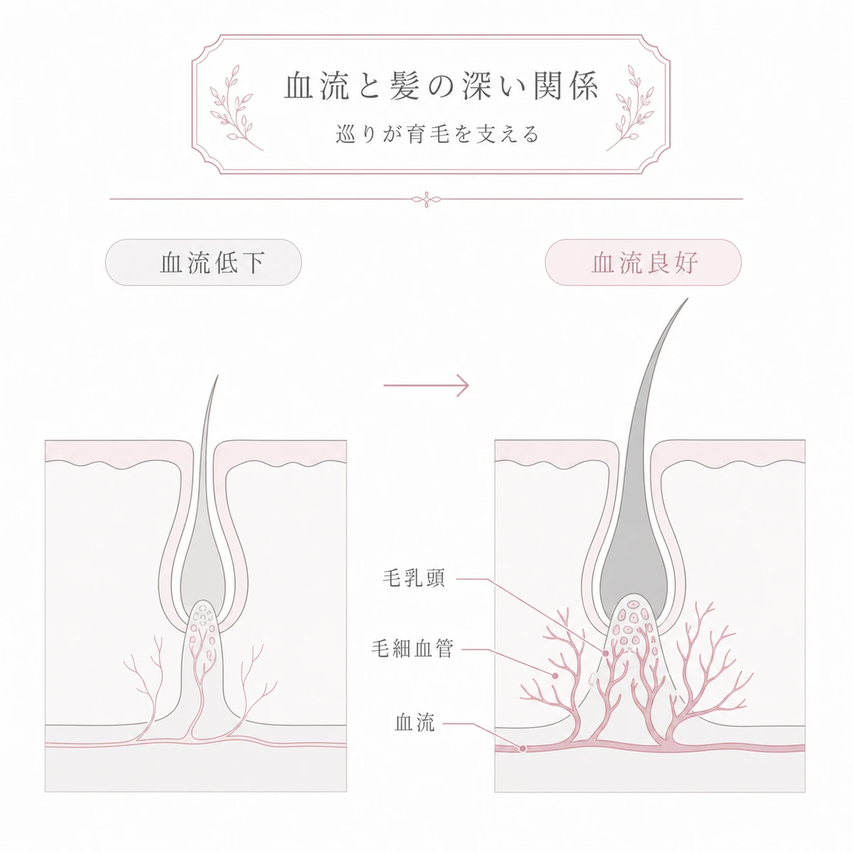 血流の良い毛包と滞った毛包を左右で比べ髪の育ち方の違いを表した線画イラスト