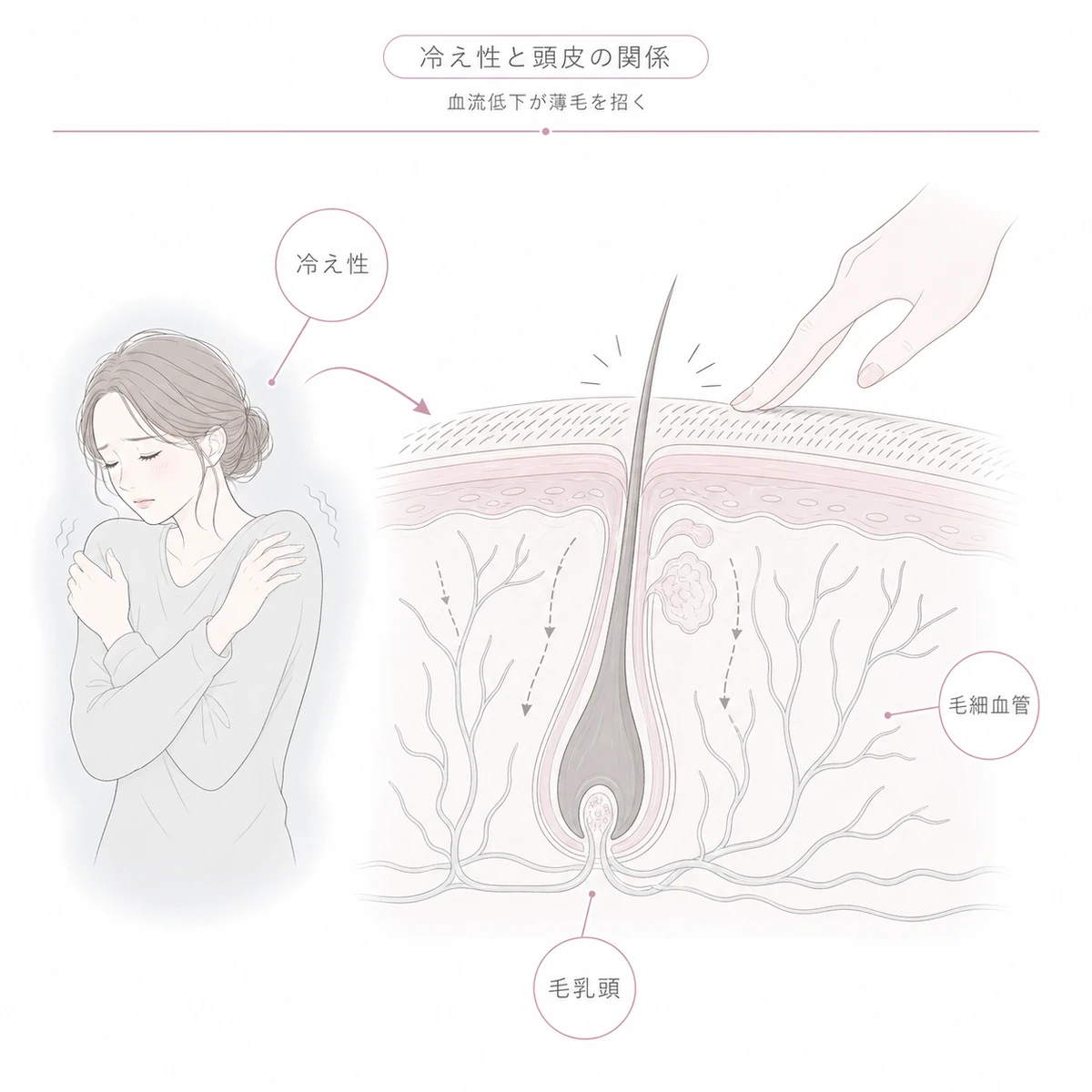 冷え性で末梢血管が縮み頭皮の毛乳頭への血流が減るしくみを表した線画イラスト
