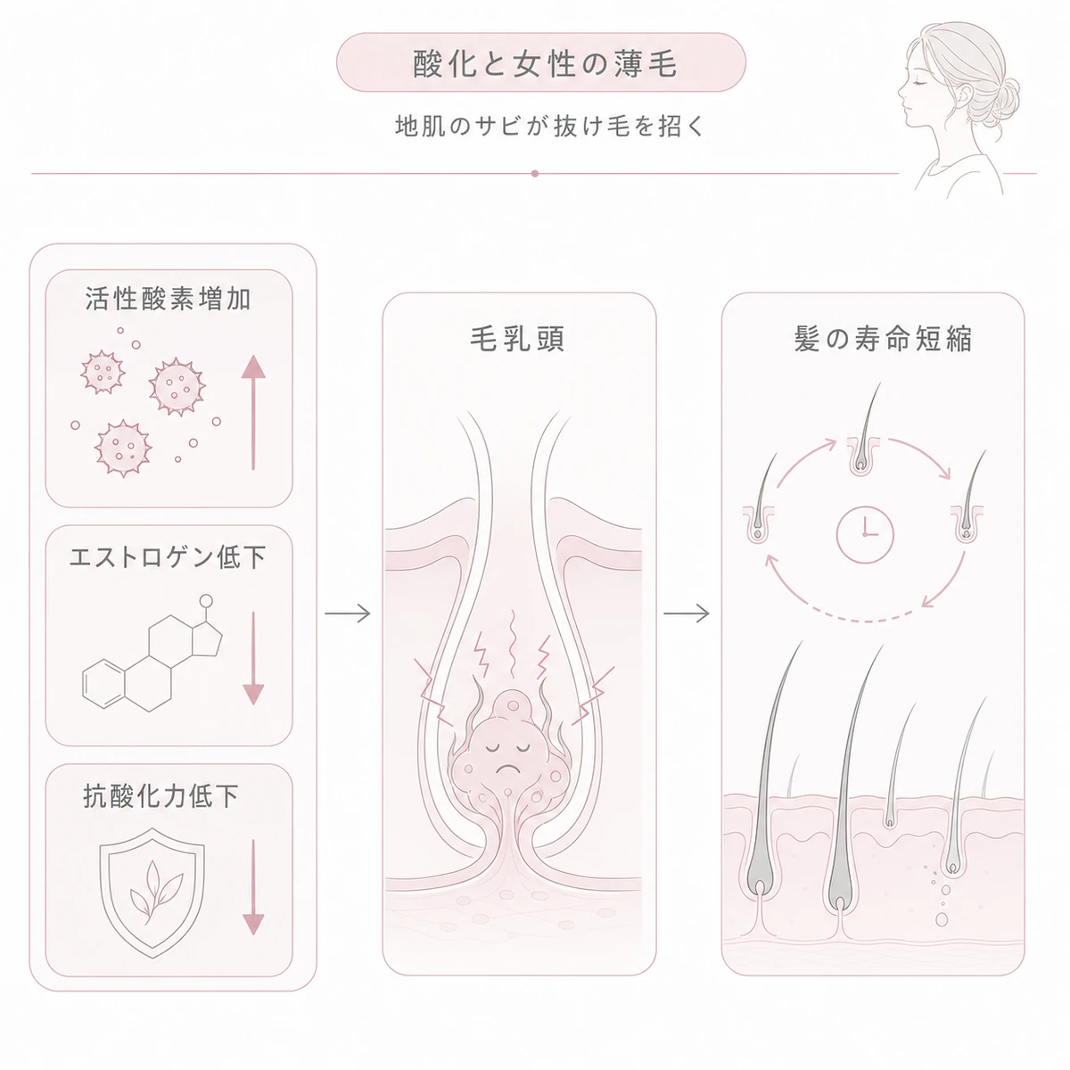 活性酸素の増加とエストロゲン低下が毛乳頭細胞を傷つけ髪の寿命を縮める酸化と薄毛の関係を表した線画イラスト