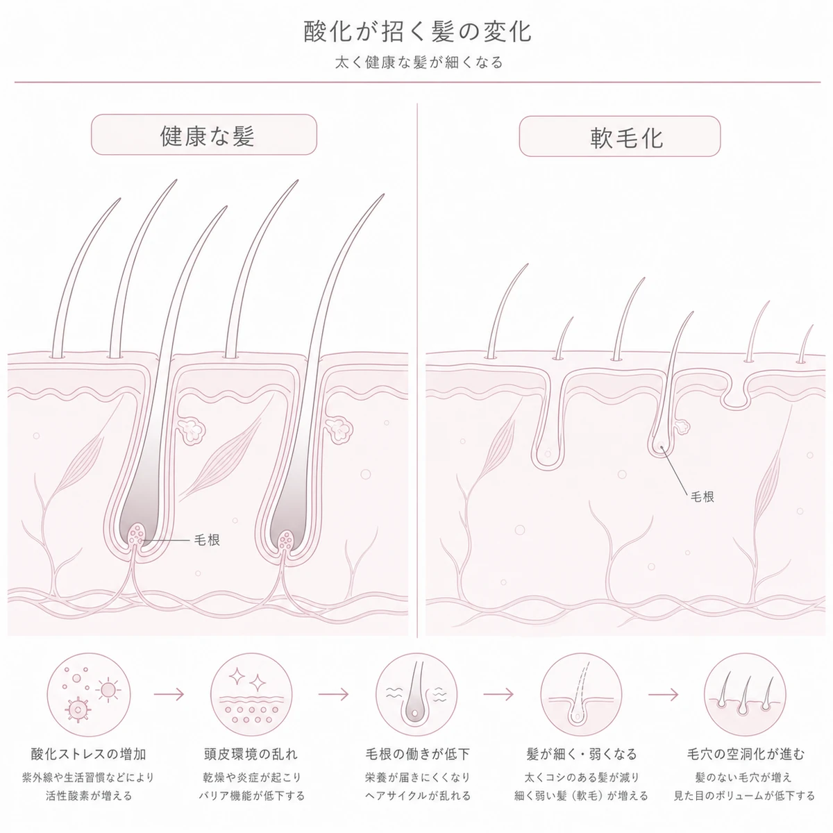 健康な太い髪と酸化で軟毛化し細く抜けやすくなった髪を見比べた線画イラスト