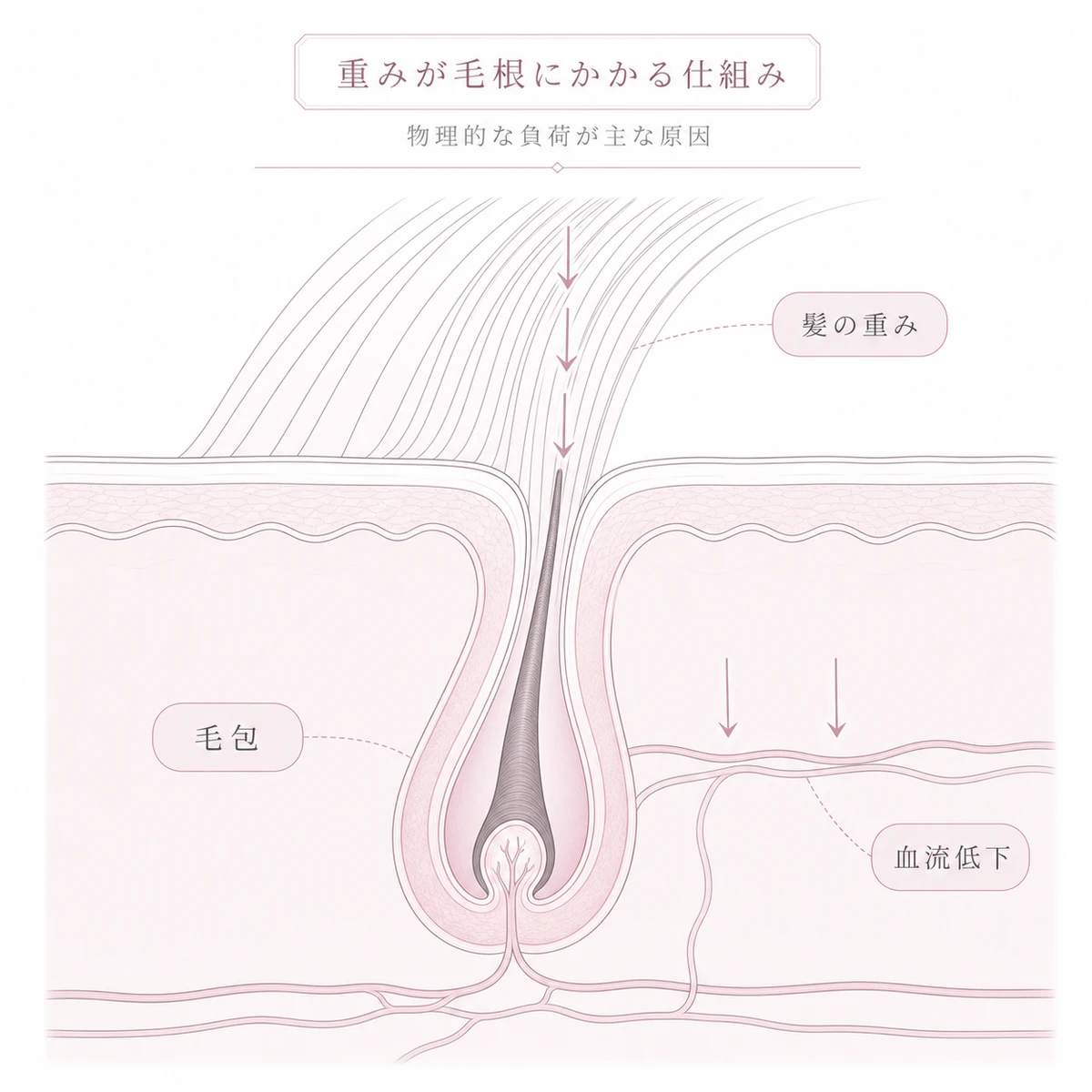 長い髪の重みが下向きに毛包へかかり血流が低下する頭皮断面を表した線画イラスト