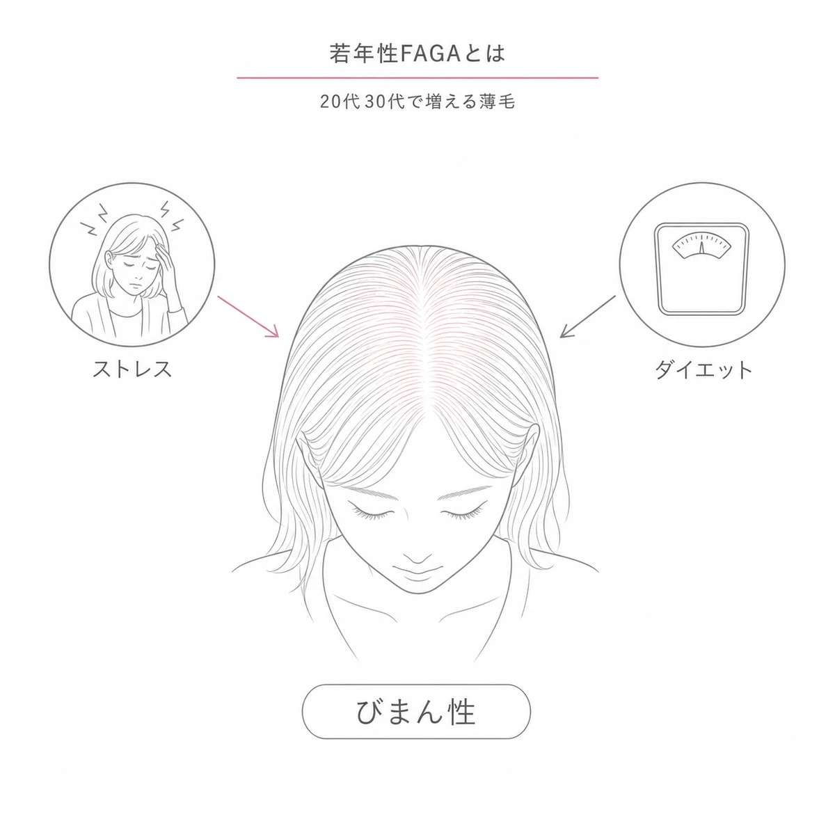 20代30代の若い女性にストレスやダイエットを背景に起こる若年性FAGAの特徴を表した線画イラスト