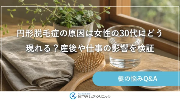 円形脱毛症の原因は女性の30代にどう現れる？産後や仕事の影響を検証