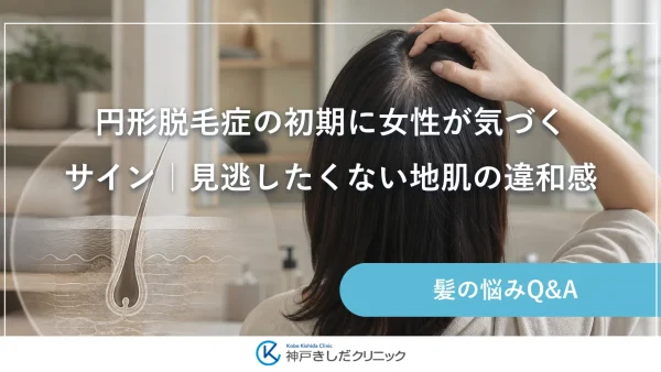 円形脱毛症の初期に女性が気づくサイン｜見逃したくない地肌の違和感