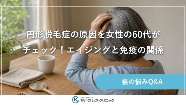 円形脱毛症の原因を女性の60代がチェック！エイジングと免疫の関係