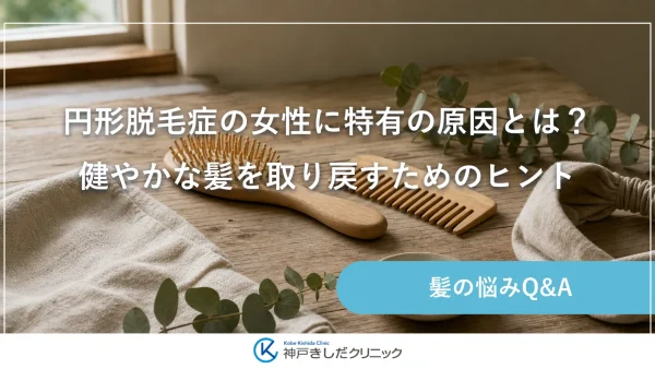 円形脱毛症の女性に特有の原因とは？健やかな髪を取り戻すためのヒント