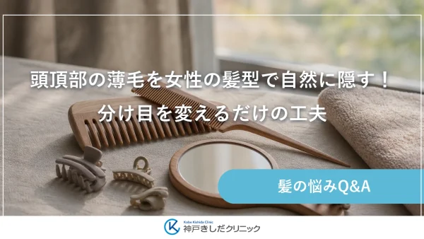 頭頂部の薄毛を女性の髪型で自然に隠す！分け目を変えるだけの工夫