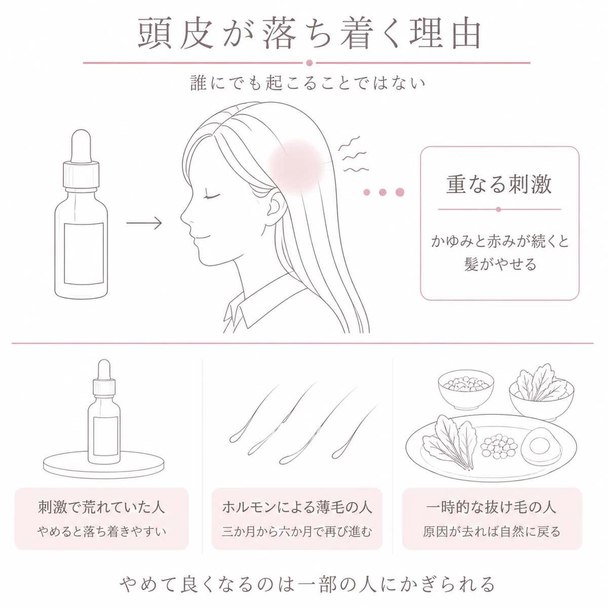 育毛剤の刺激で荒れていた頭皮とやめた後に分かれる三つの道すじを上下二段で表したイラスト