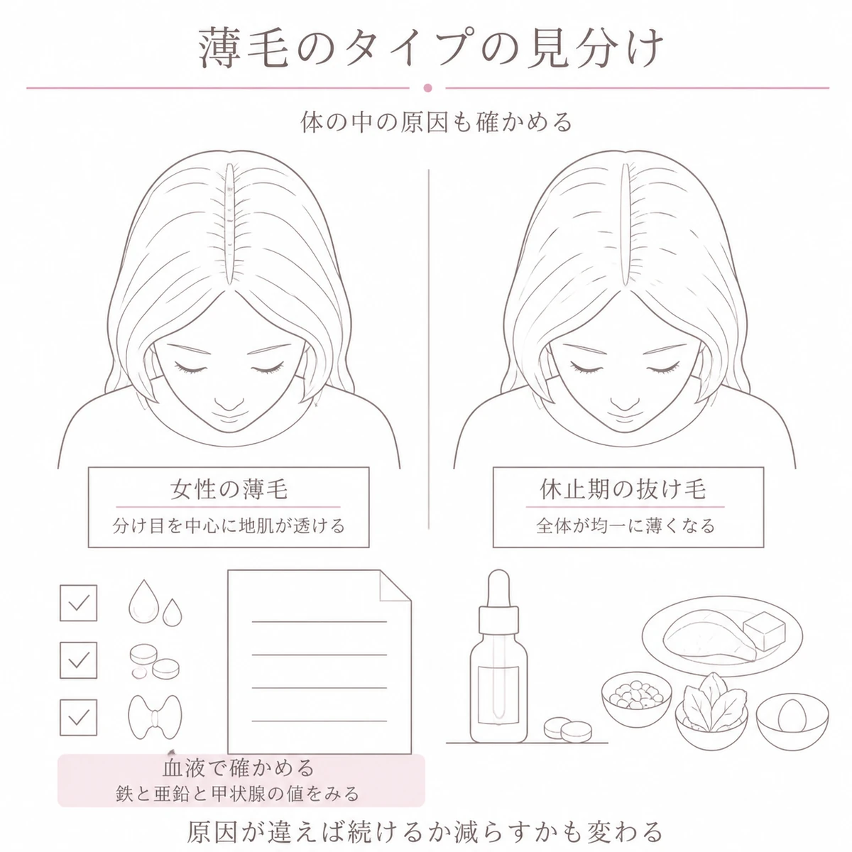 分け目を中心に透ける薄毛と全体が均一に薄くなる抜け毛の違いと血液で調べる項目を左右に分けたイラスト