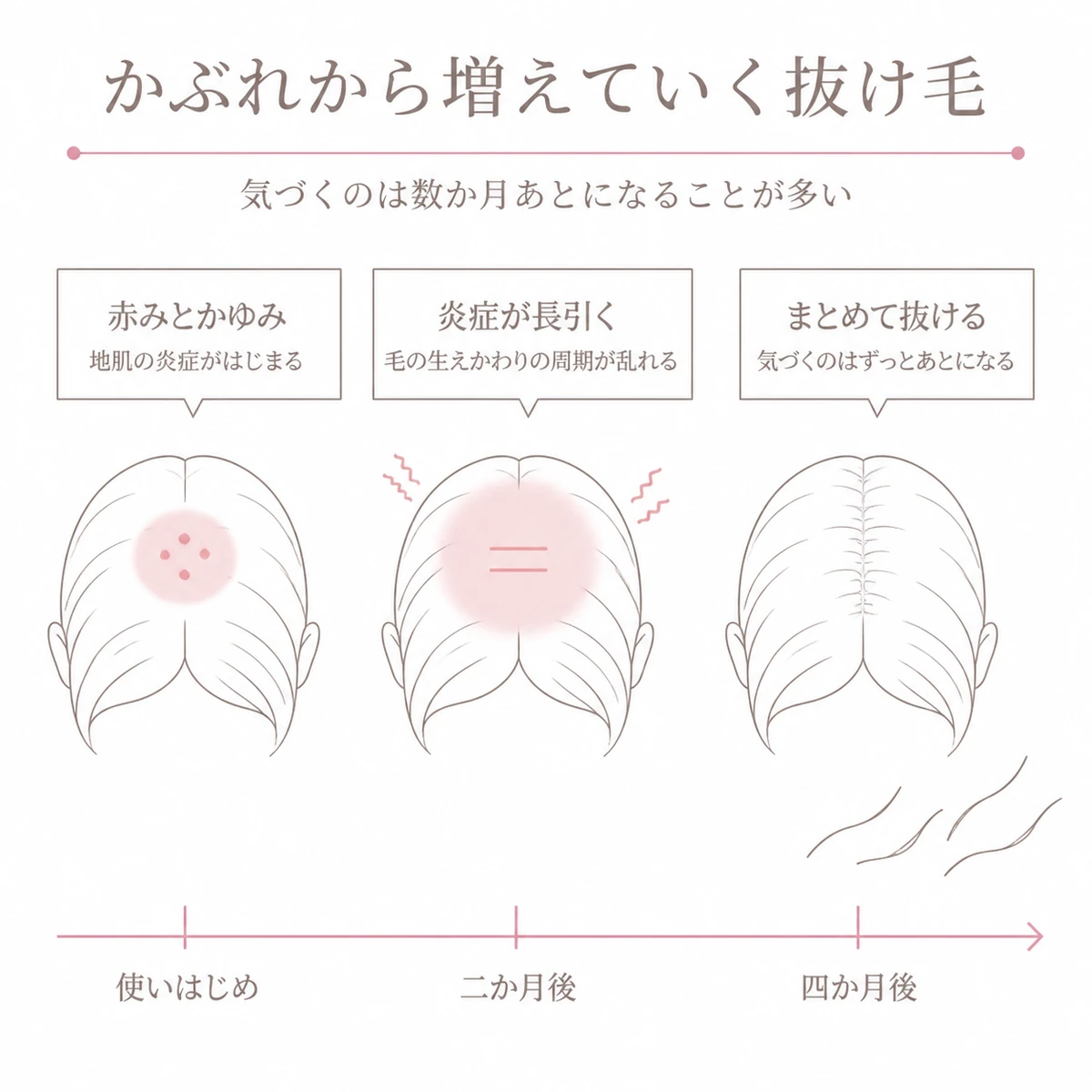 地肌の赤みから数か月あとの抜け毛の増加までを左から右への時間の流れで描いたイラスト