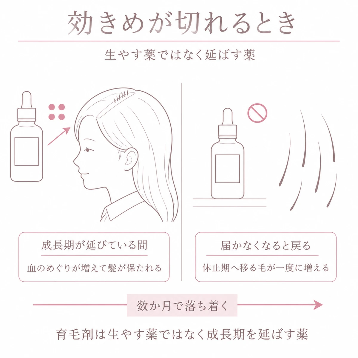 育毛剤を使っている間と使うのをやめた後で髪の成長期の続き方が変わる仕組みを左右に分けたイラスト