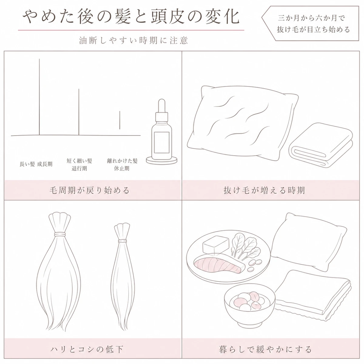 育毛剤の中止後に毛周期が戻り抜け毛やハリの低下が起きる変化を四つのます目に分けたイラスト