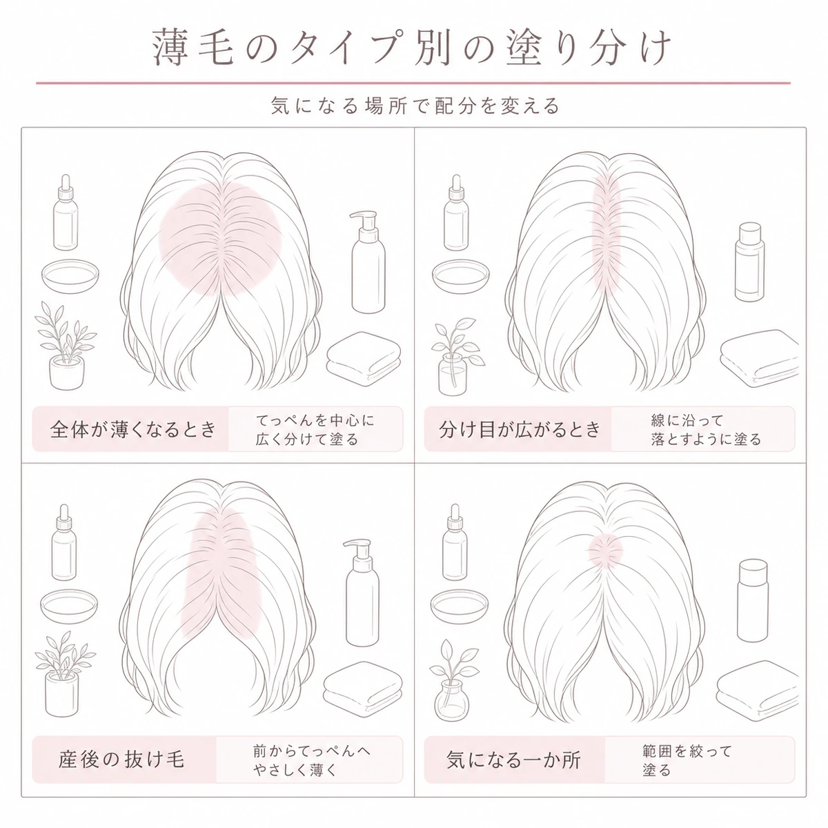 びまん性や分け目や産後など薄毛のタイプごとに塗る範囲を変える様子を四つに分けた線画イラスト