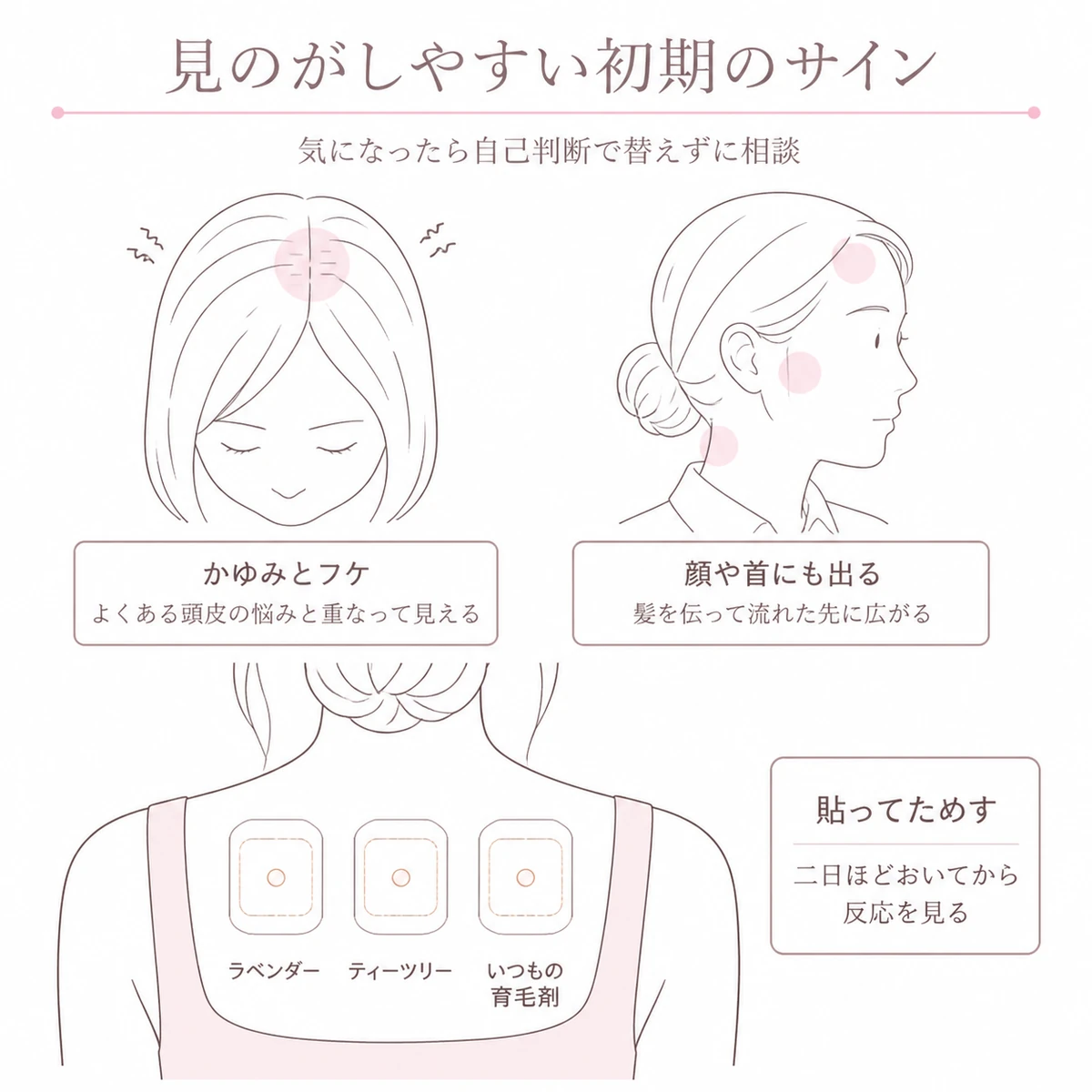 頭皮のかゆみと顔や首への広がりと背中に貼ってためす検査を三つの区域に分けて描いたイラスト
